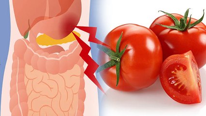 Скачать видео: कब्ज में टमाटर खाना से क्या होता है? कब्ज में टमाटर खाना चाहिए या नहीं? । Boldsky*Health