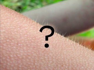 Why do we get goosebumps when we_re cold_