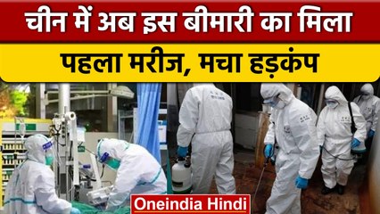 Monkeypox Update: China में मिला मंकीपॉक्स का पहला मामला, मचा हड़कंप | वनइंडिया हिंदी *News