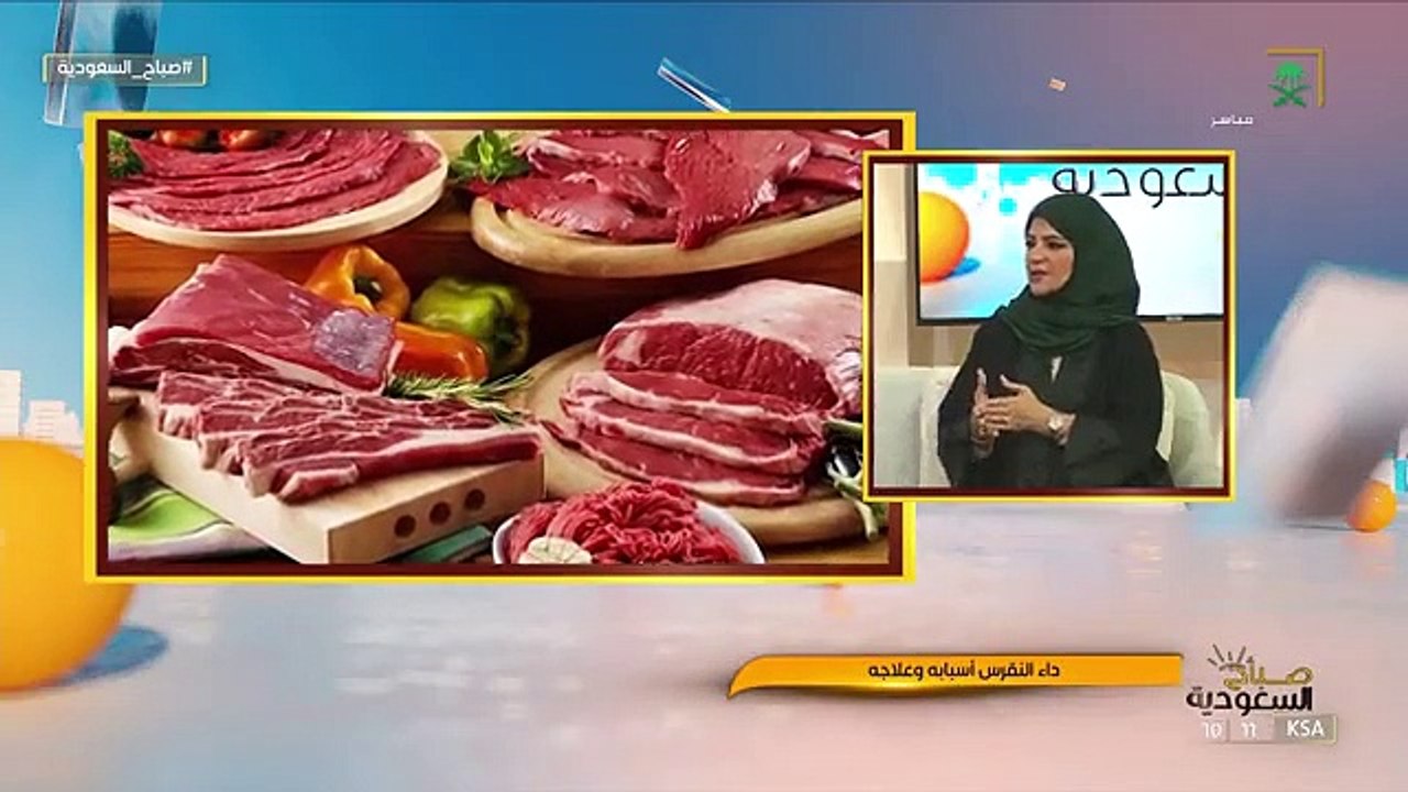 إخصائية تغذية توضّح طريقة معرفة كمية البروتين التي يحتاجها الجسم