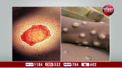 monkeypox Alert: देश में मिले मंकीपॉक्‍स संक्रमण के 3 सब क्‍लस्‍टर