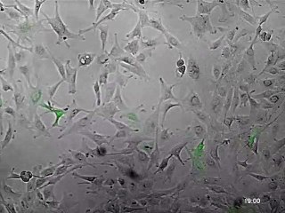 Les virus tueurs de cancers