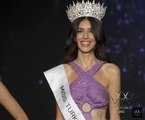 2022 Miss Turkey World güzeli kim oldu? Miss Turkey yarışmacısı Nursena Say kimdir?