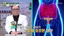 여성이 변비에 잘 걸리는 이유는 호르몬 때문!? TV CHOSUN 20220921 방송