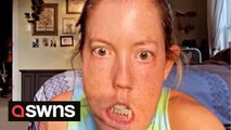 US mum with facial condition is teaching her four adopted sons to 