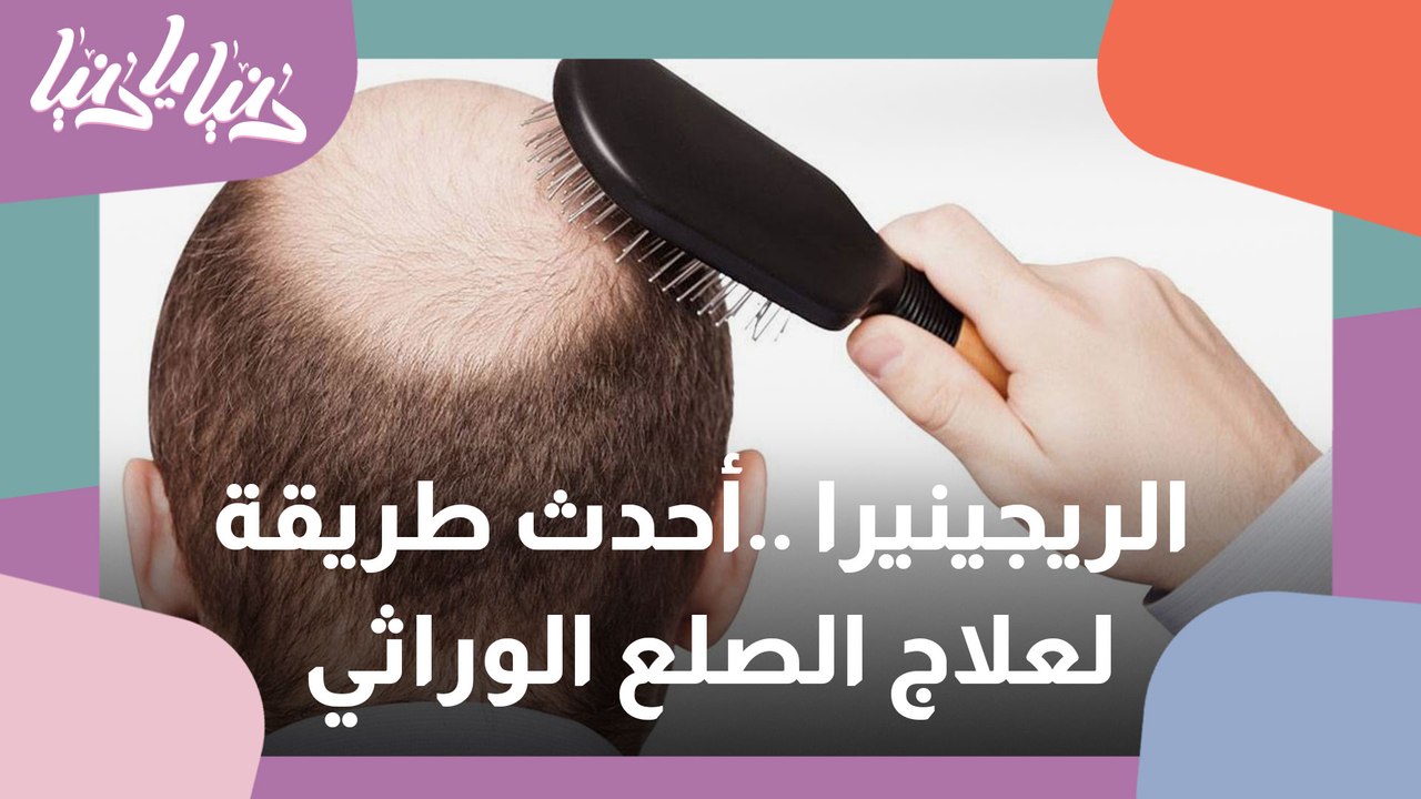 تعرفوا على تقنية الريجينيرا أحدث طريقة لعلاج الصلع الوراثي