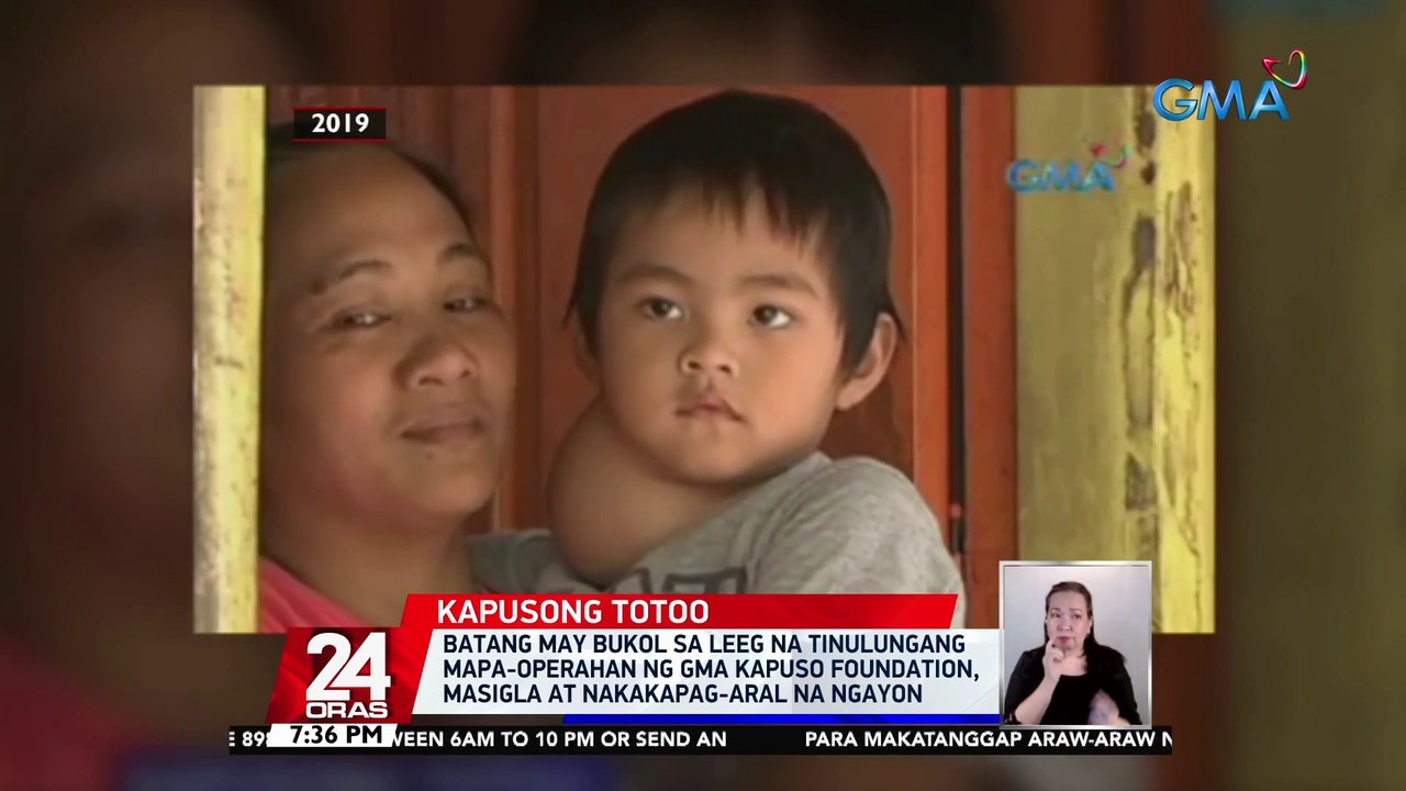 Batang may bukol sa leeg na tinulungang mapa-operahan ng GMA Kapuso ...