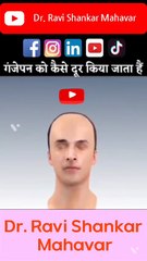 गंजापन दूर करने की सर्जरी। #shorts  @Dr. Ravi Shankar Mahavar ​