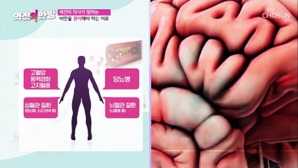 여러 합병증을 유발하는 질환은 바로 비만 TV CHOSUN 20220923 방송
