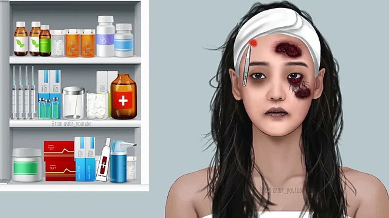 ASMR_Eye_discharge_removal_animation_-_Eyelid_big_acne_extrusion_and_lashes_lice_deep_cleaning(360p)