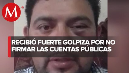 Regidor fue golpeado por un grupo de choque presuntamente enviado por el alcalde de Ayahualco