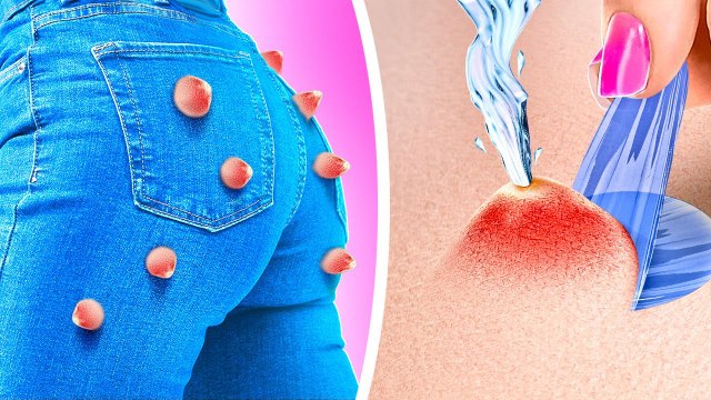 COMMENT SE DÉBARRASSER DES BOUTONS ! ASTUCES BRILLANTES DE BEAUTÉ QUE TU DEVRAIS CONNAÎTRE