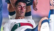 Portekiz milli maçında korkunç anlar! Ronaldo kanlar içinde yere yığıldı