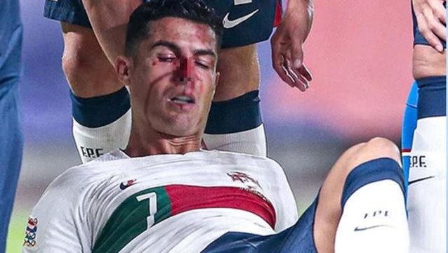 Portekiz milli maçında korkunç anlar! Ronaldo kanlar içinde yere yığıldı