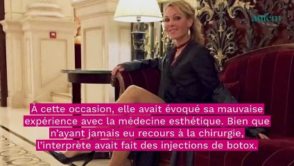 Indra : la chanteuse revient sur sa terrible expérience de la médecine esthétique