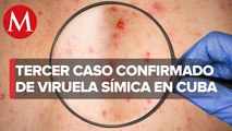 Cuba confirma tercer caso de viruela del mono