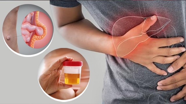 पित्त की थैली में Cancer symptoms कैसे पता लगाएं | gallbladder cancer kaise hota hai | *health