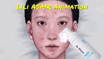 ASMR [MMD]Animation of how acne treatment was done Lili ASMR Animation