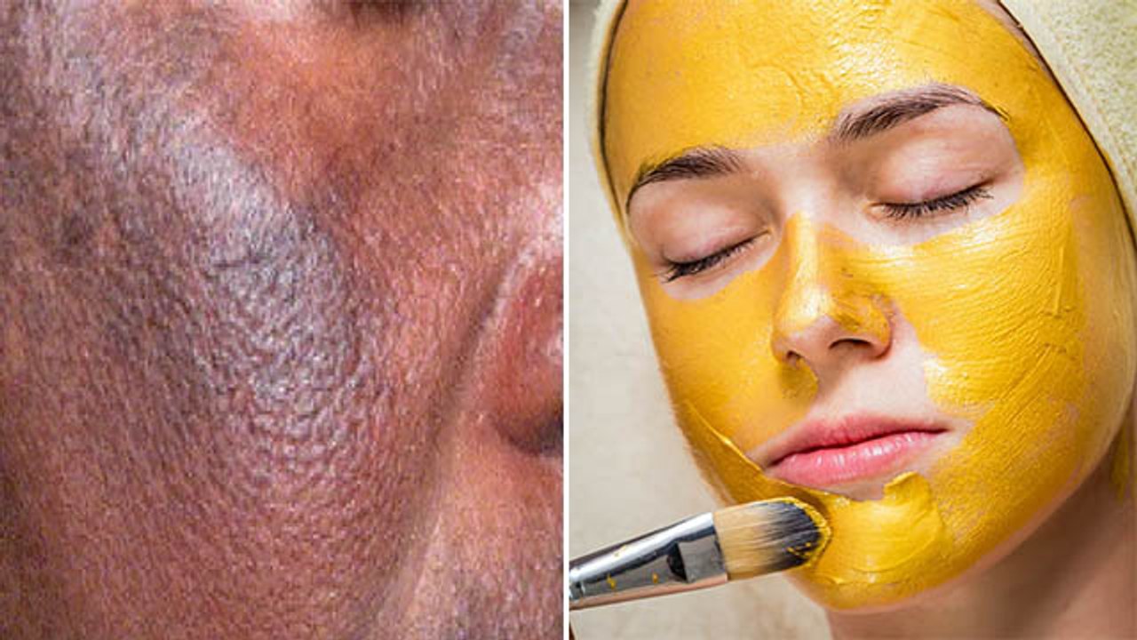 चेहरे पर रोज बेसन लगाने से क्या होता है ?Chehre Par Roj Besan Lagane Se Kya Hota Hai।Boldsky *Health