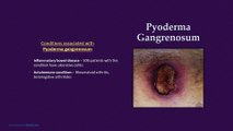 Pyoderma Gangrenosum - What conditions are associated with it & What is the Treatment?