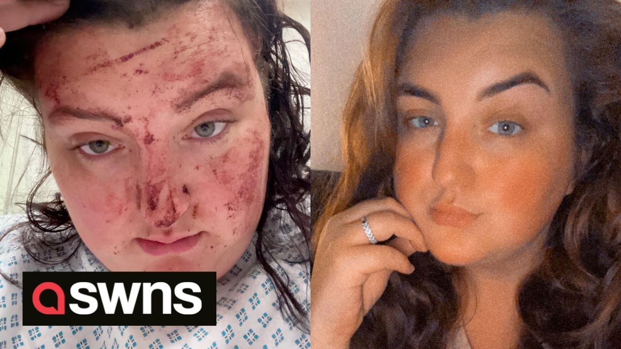 A heartbroken mum has revealed how she lost her unborn baby after she was struck by a driver who injured 11 others during a horror crash at a car meet.