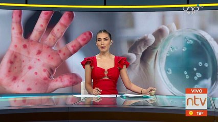 Montero reporta el primer caso de la Viruela del Mono.