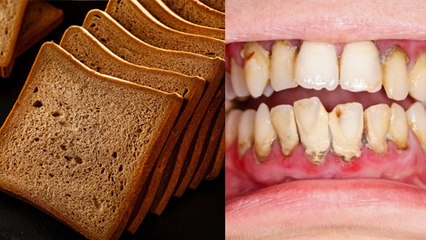 Brown Bread खाने से क्या होता है | Brown Bread खाने के नुकसान | Boldsky *Health