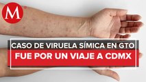 Incrementa la viruela del mono en Guanajuato; van 9 casos confirmados