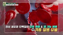 노화 & 질병 & 피부가 무너지는 원인은 ‘활성 산소’ TV CHOSUN 20220928 방송