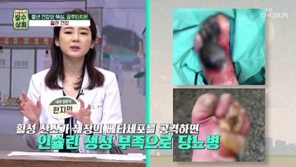 혈관 건강과 치매 예방에도 도움을 주는 글루타치온 TV CHOSUN 20220928 방송