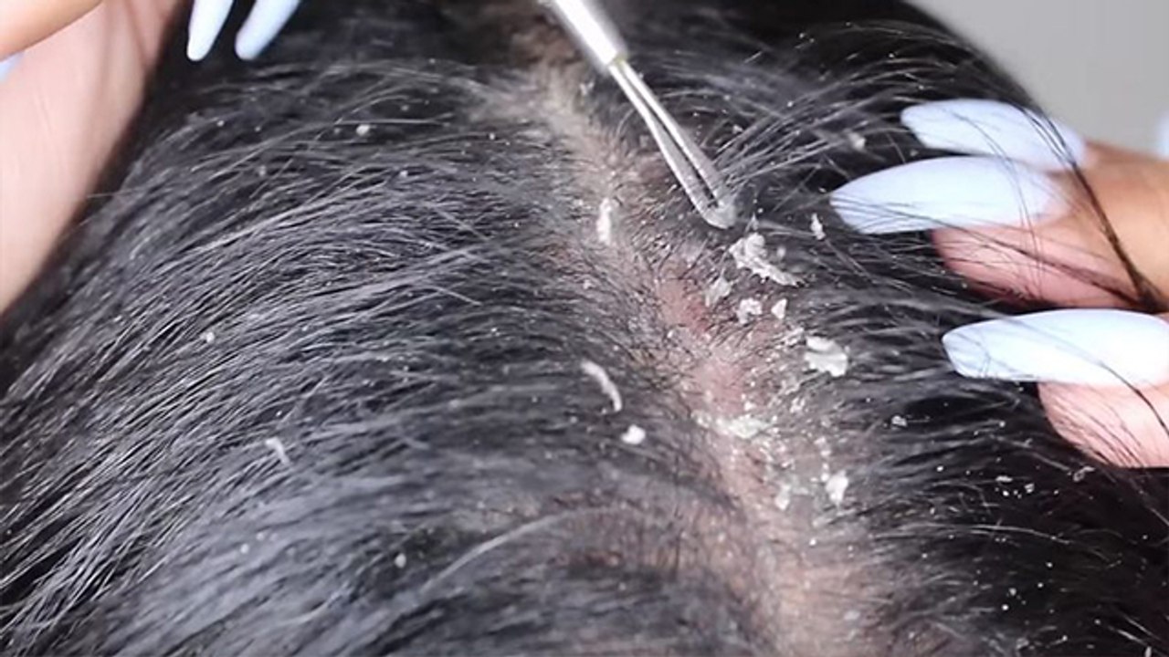 नमक के पानी से बाल धोने के फायदे | Benefits Of washing hair with salt water | Boldsky *Lifestyle