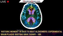 'Historic moment' in race to beat Alzheimer's: Experimental brain plaque-busting drug 'signifi - 1br