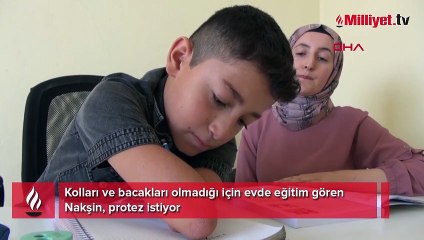En büyük hayali okula gitmek! Nakşin protez istiyor