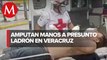 Amputan manos a presunto ladrón en Coatzacoalcos, Veracruz