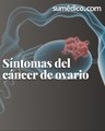 Síntomas del cáncer de ovario