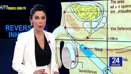 "Risug": El primer método anticonceptivo no hormonal para hombres