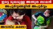 ഇരട്ട മുഖമുള്ള യുവാവ്, ഞെട്ടി സോഷ്യല്‍ മീഡിയ, ഇന്നത്തെ അവസ്ഥ കണ്ടോ