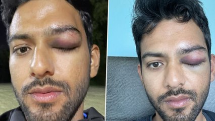 Unmukt Chand అథ్లెట్ అంటే అంత ఈజీ కాదు బ్రో *Cricket | Telugu OneIndia