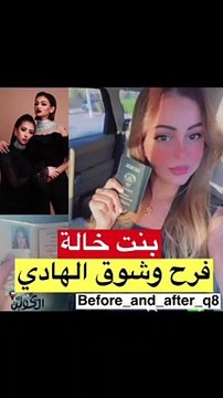 ابنة خالة فرح الهادي تخطف الأنظار بجمالها
