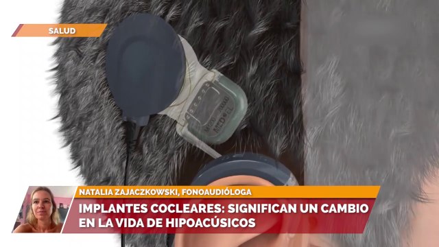 Implantes cocleares significan un cambio en la vida de Hipoacúsicos