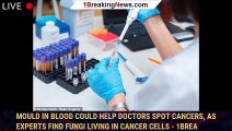 Mould in blood could help doctors spot cancers, as experts find fungi living in cancer cells - 1brea
