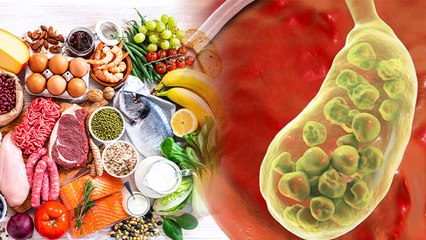 Gallbladder Stone में क्या खाएं क्या नहीं ? | Gallbladder Stone me kya khaye kya na khaye | *health
