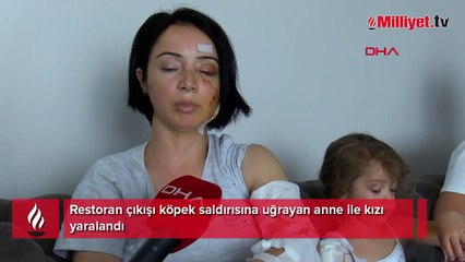 Restoran çıkışı anne ile kızı dehşeti yaşadı! 'Bizi görür görmez üzerimize geldiler'