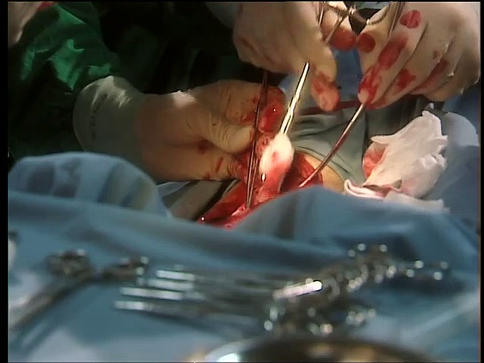 Alphateam - Die Lebensretter im OP Staffel 5 Folge 8 HD Deutsch