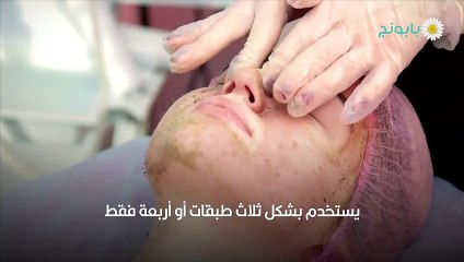 تقشير البشرة