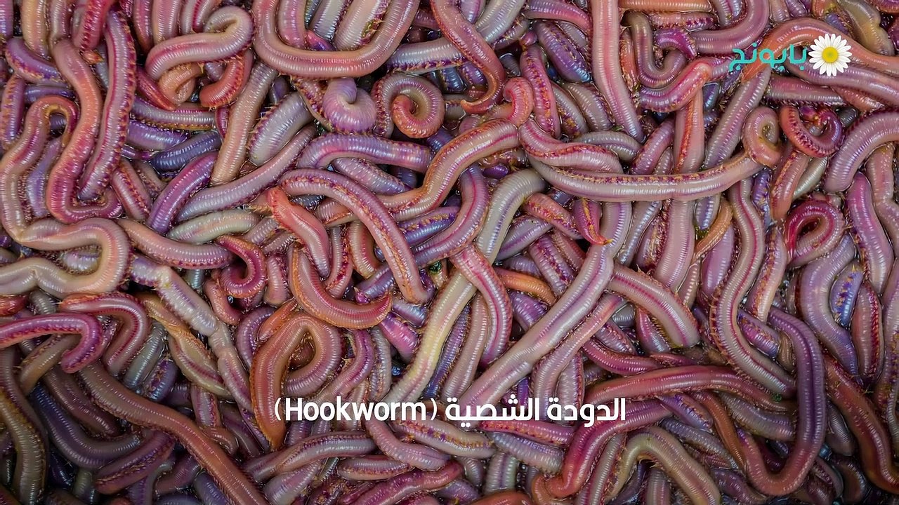 أنواع ديدان البطن وأشكالها