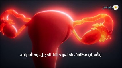 جفاف المهبل