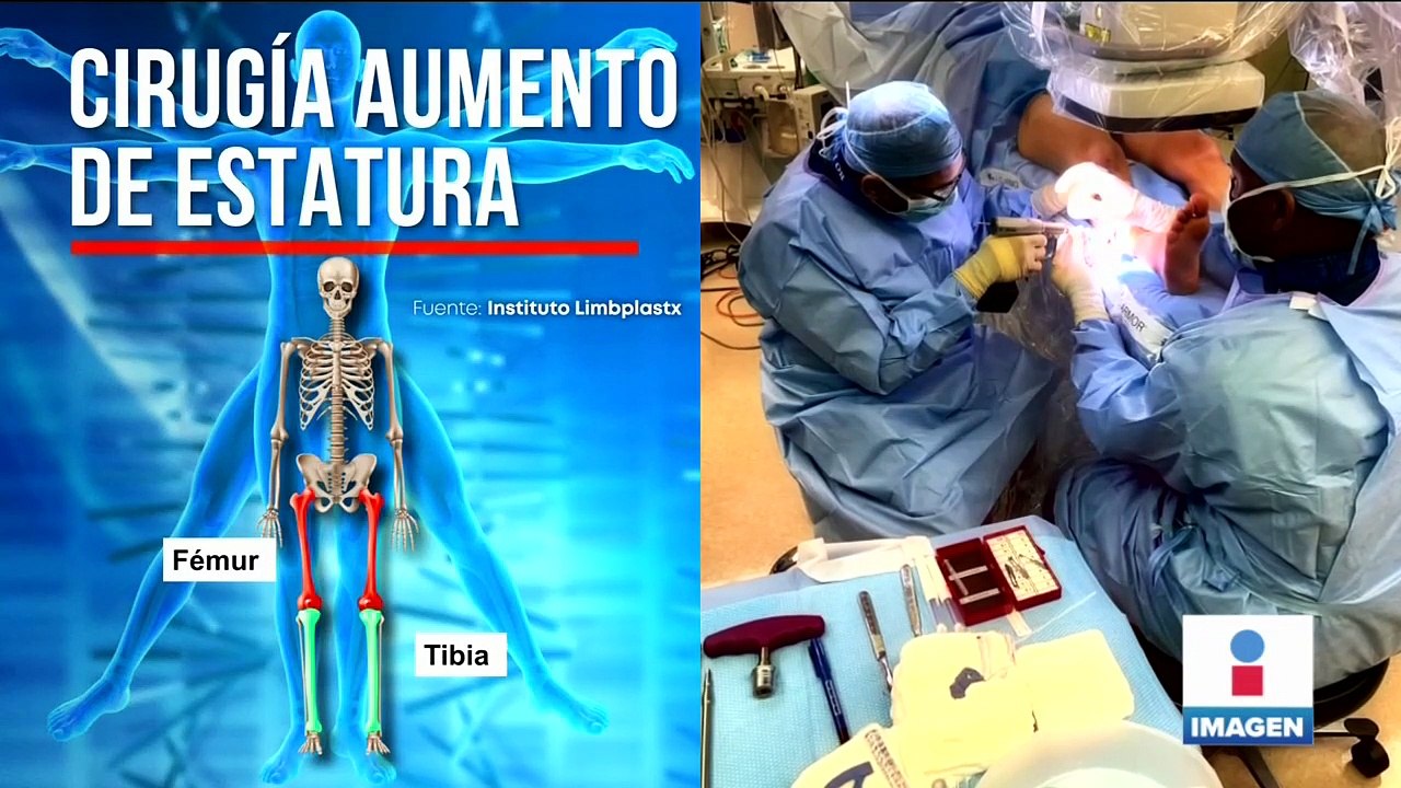 Cirugía de aumento de estatura