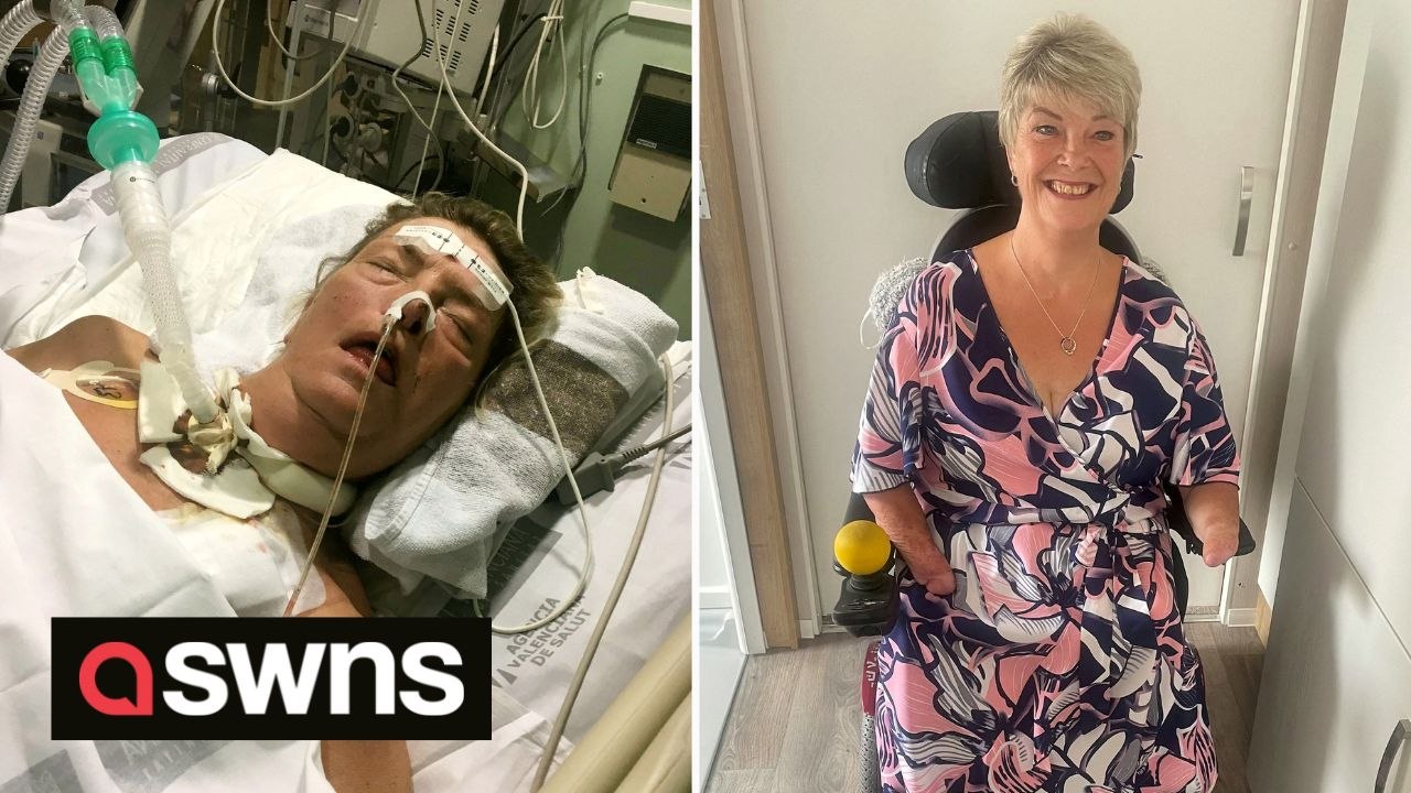 Woman is to undergo rare double hand transplant surgery having lost all her limbs to sepsis