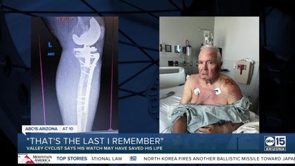 When he couldn't dial 911, his watch did and saved his life